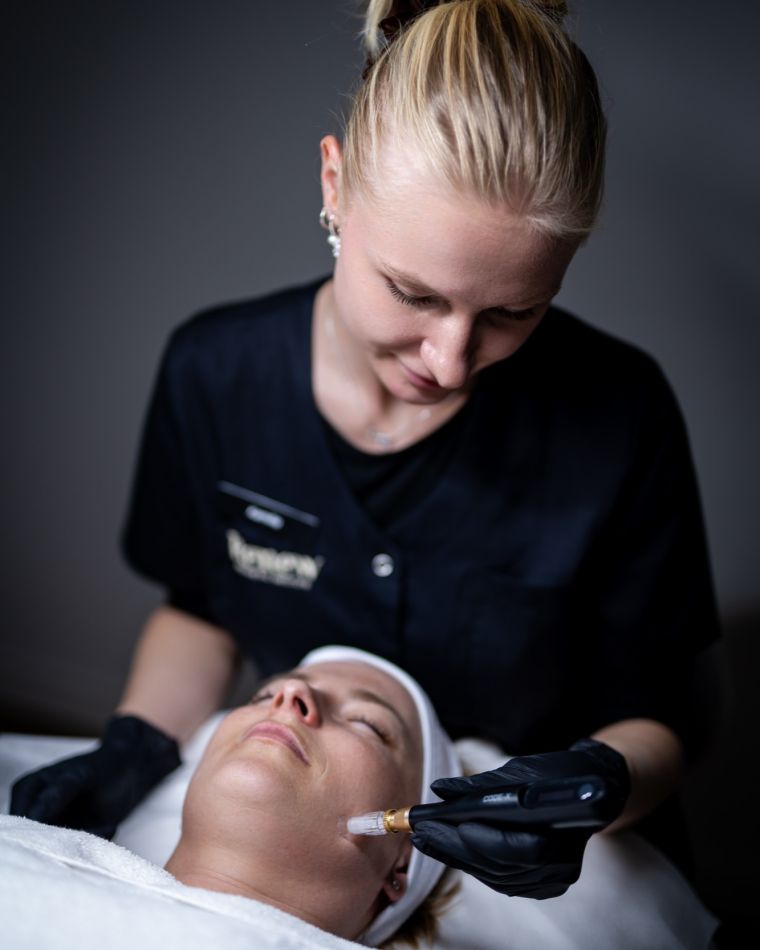 Microneedling-pen føres over kind
