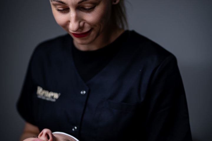 Microneedling-pen føres over kind
